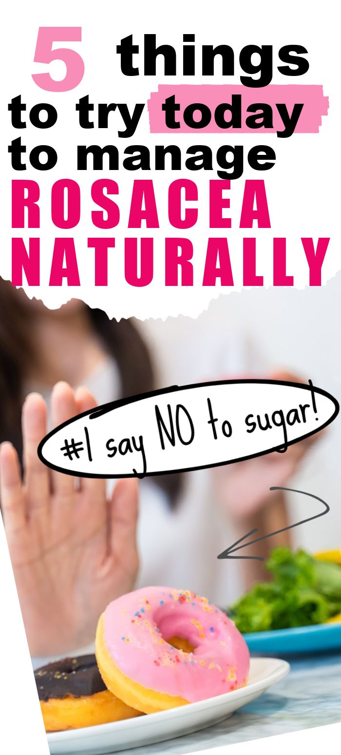 Natural ways to manage rosacea